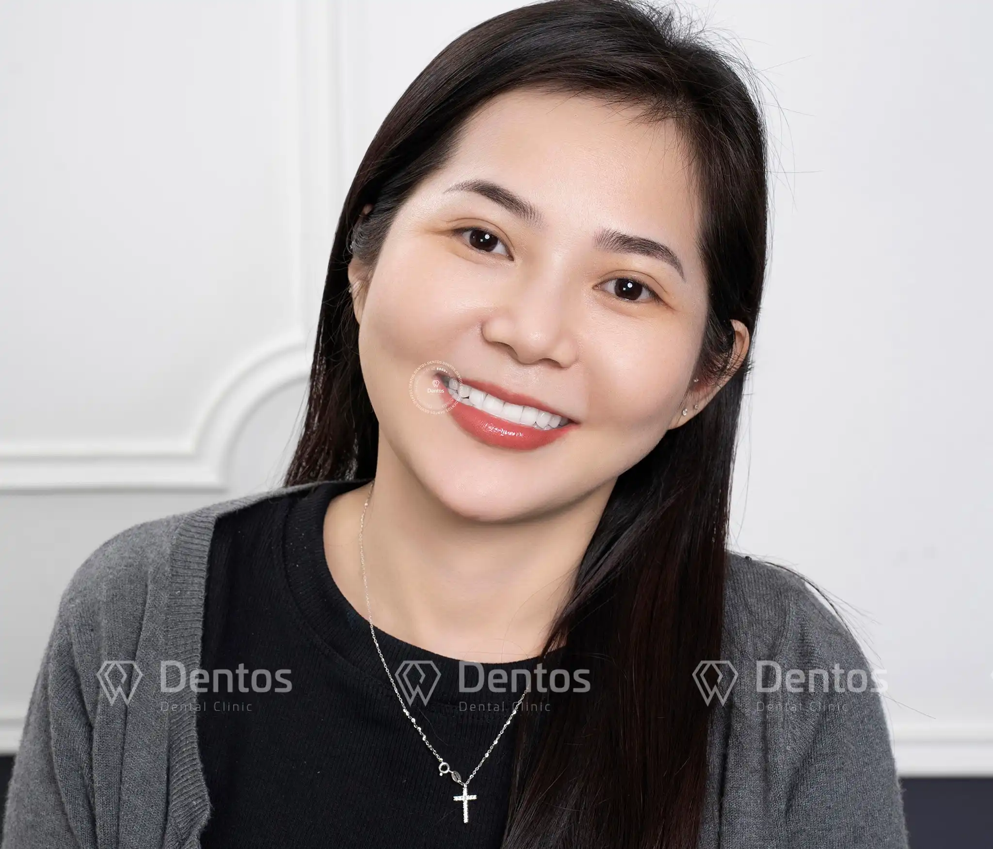 5 điều cần chuẩn bị kỹ lưỡng trước khi quyết định bọc răng sứ